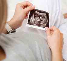 2 Скрининг при бременност. Какво е включено?