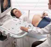 33 Седмица на бременността: ултразвукови