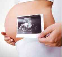38-То седмица на бременността: предвестници на труда в мултипарна