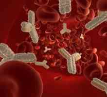 Изпитването на кръв за антитела към Giardia