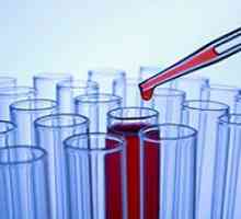 Кръвни тестове за тироидни хормони