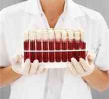 Анализ на кръв за определяне на кръвна група