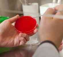 Изследване на урина за засяване