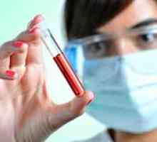 Биохимичен анализ на кръв за желязо