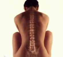 Болки в гърба след раждането: причини и лечение