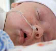 Церебрална исхемия при новородени