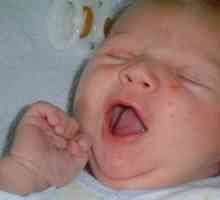 Какво може да предизвика обрив по лицето на новороденото