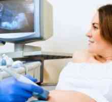 Какво може да се види на ултразвук в 32-та седмица от бременността?