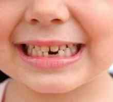 Какво трябва да знаете за първични зъби при децата?