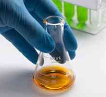 Какво прави тест на урината?