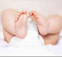 Дерматит при бебета: формата и лечението