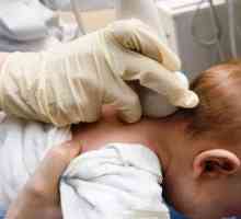Защо мозъка ултразвук бебе
