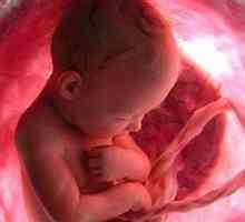 Единична пъпна артерия по време на бременност, за разбиране на причините за аномалия