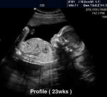 Снимки с ултразвук 22 седмици бременна