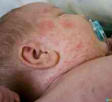 Facial обрив при кърмачета малко дете