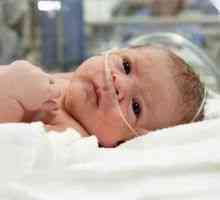 Хипоксия при новородени: причини, симптоми и лечение