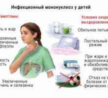 Инфекциозна мононуклеоза при деца: симптоми и лечение