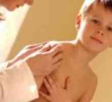 Инфекциозна мононуклеоза при деца