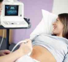 Колко често може да направи ултразвук по време на бременност