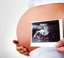Как да се установи синдрома на Даун по време на бременност