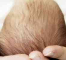 Мозъчна киста при новородени - когато това е опасно?