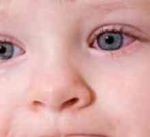 Червени очи от едно дете