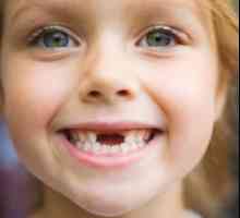 Криви зъби при децата