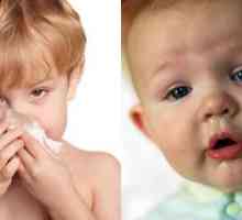 Лечение на обикновената настинка при децата