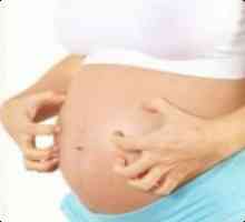 Зостер по време на бременност