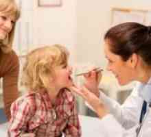 Мононуклеоза при деца