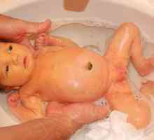 Жилки на кожата при новородени