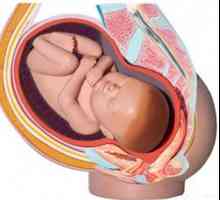 Ниско на плацентата по време на бременност - какви са шансовете?