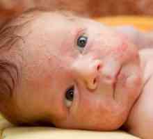 Опасно ли е подуване на млечните жлези при новородени