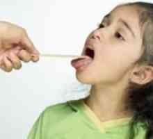 Стрептокок в гърлото при деца