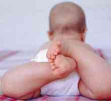 Пелена дерматит при деца - произтича от кожата триене срещу мръсни памперси