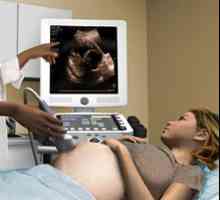 Първо ултразвук прожекцията на по време на бременност