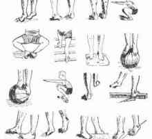 Плоски крака при децата - Лечение