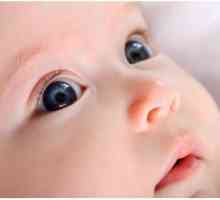 Защо тлеят очите на новородено дете?