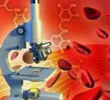 Повишена лимфоцитите в кръвта на дете