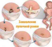 Правила за обработка и грижи за новороденото пъпа