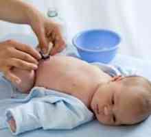 Правила за преработка на пъпа новородени