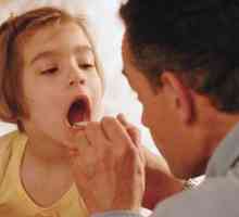 Правилното лечение на гърлото при деца на възраст от 2 до 5 години