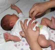 Правилната грижа на пъпната връв на новородени