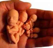Причините и последствията от спонтанен аборт в ранна бременност