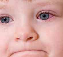 Причините за червени очи от детето и тяхното лечение