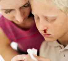 Причини за възникване на кръвотечение от носа при децата