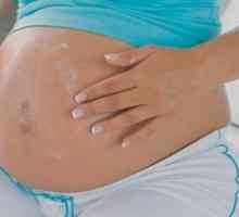 Причини за сърбеж по корема при бременни жени