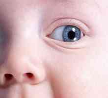 Причините за образуване на синини под очите на деца