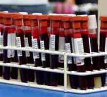 Декодирането на кръвни изследвания при децата