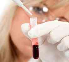 Дешифрирането на общия анализ на кръв